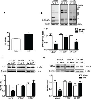 Protein O-GlcNAcylation as a nutrient sensor signaling placental dysfunction in hypertensive pregnancy